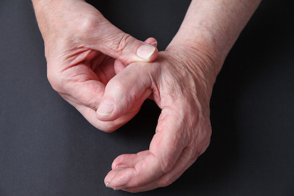 kéz artrózisa 1 fok