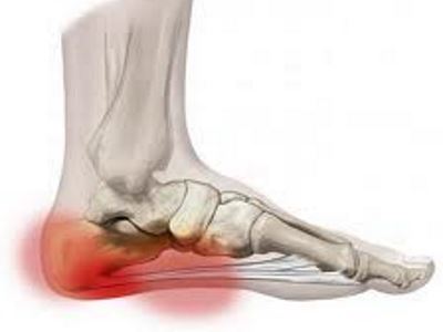 A lábfej lábujjai ízületeinek gyulladása - Melyek lehetnek a lábfej fájdalom okai?