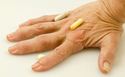 mely ízületeket érinti a rheumatoid arthritis