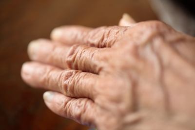 A reumatoid artritisz kialakulása és kezelése | BENU Gyógyszertár