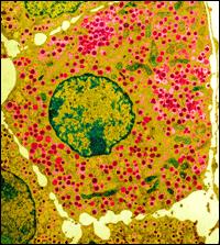 Cukorbetegség - Olimpiq SL - vércukorszint őssejt kapszula