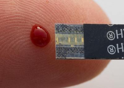 Forradalmasíthatja a cukorbetegség kezelését egy új chip