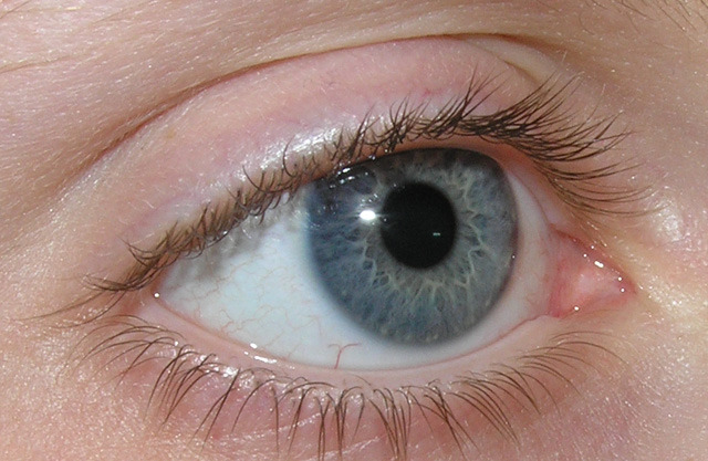látás karotinoidok a látás helyreállításának képessége glaukómában