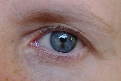 hogyan erőltette meg a szemét sérvek befolyásolják a látást