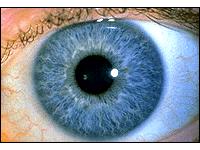 látás egy szem vonásokkal egyik szemében teljesen elvesztette a látást
