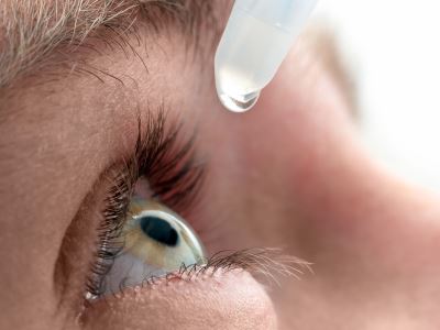 száraz szem homályos látás hyperopia amblyopia