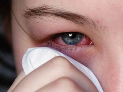 vírusos kötőhártya-gyulladás és látás
