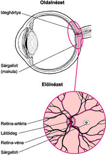 makula degeneráció tünetei