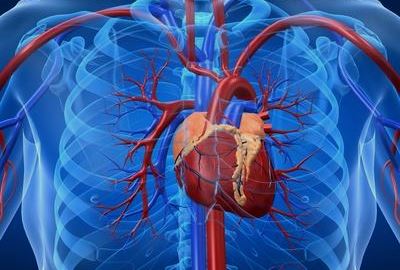 A mozgásszegény életmód szívbetegséghez vezethet