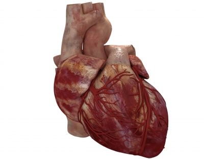 szívroham egészségügyi kockázatok