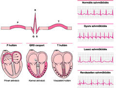 EKG szív egészsége