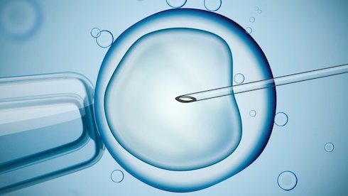 aki magas vérnyomással IVF-et végzett