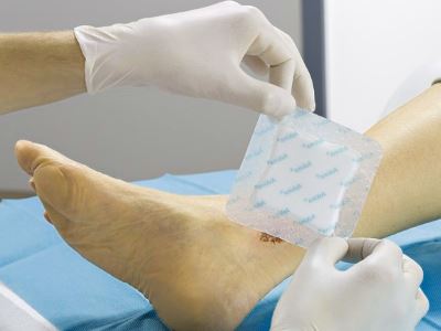 Cukorbetegségben szenvedő lábfekélyek kezelésére szolgáló eszközök