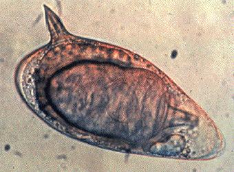 bélbetegség parazita a féreghajto mellekhatasai