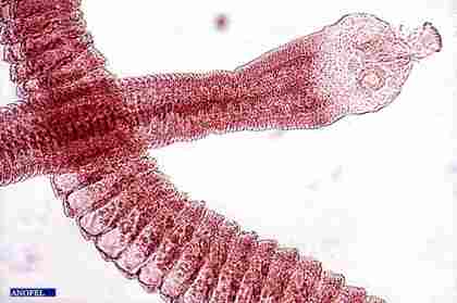 Instant tudomány: Parazita is okozhat rákot, elképedtek a tudósok | pano-dent.hu