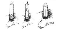 CAVERJECT 20 µg por és oldószer oldatos injekcióhoz