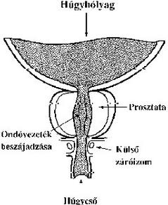 diffúz változások a prosztatában