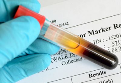 papilloma warzen erfahrungen