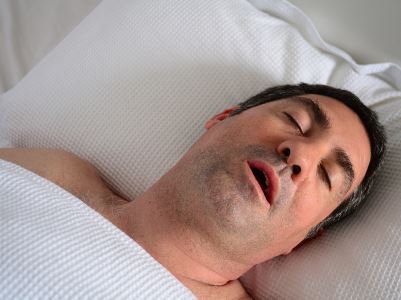 Sleep apnea - Wikipedia