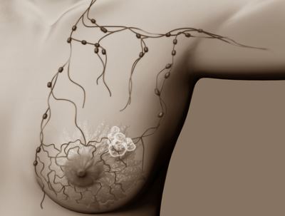 a templom férge endometrium rákos vérzés mintázata