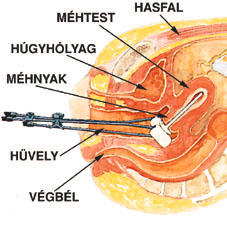 a méhnyakrákra vonatkozó irányelvek szépek