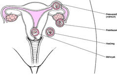 hpv u muzu lecba ár gyógyszer pinworms