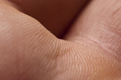 vörös foltok a gyomorban és a kezek viszketnek pikkelysömör súlyosbodása, mint kezelni