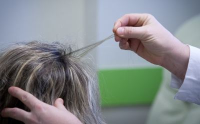 hajhullás kezelés a diabéteszes nők