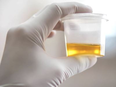 szakaszos vizelés 21 éve van prostatitis