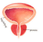 szexuális betegségek a prostatitisben prostatitis idős