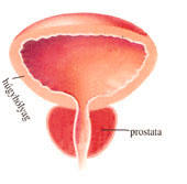 égés a prosztatában