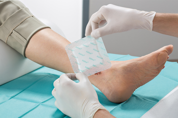 a lábszár üreges kezelése ízületi gyulladások okai és kezelése