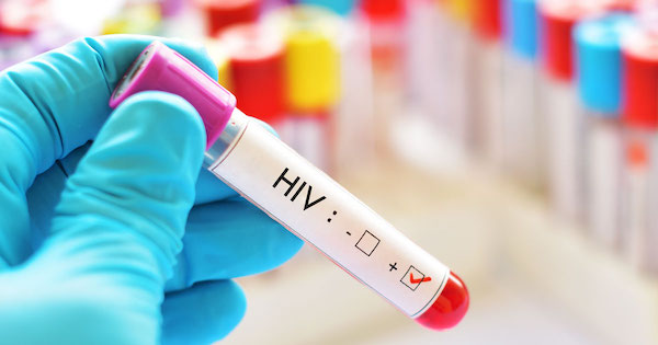 HIV gyógyszerek és fogyás
