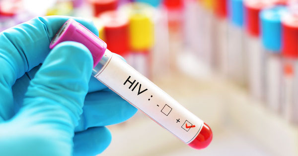 HIVinfo - HIV: amit a vírusról tudni érdemes