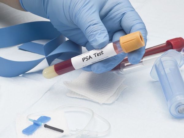 A prosztatarák diagnosztizálásának eszközei és lépései
