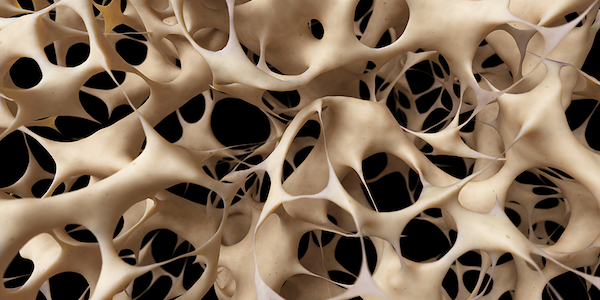 Szimpatika – A csontritkulás hatékony kezelése