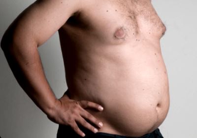 Fogyás kórosan elhízott férfiaknál