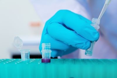 diabetes typ 2 ernährung cukor a vizeletben cukorbetegséggel 2 kezelés